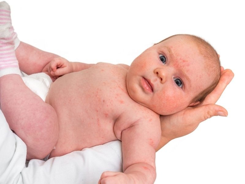 Це небезпечно: 7 тривожних симптомів у немовляти, які не можна пропускати